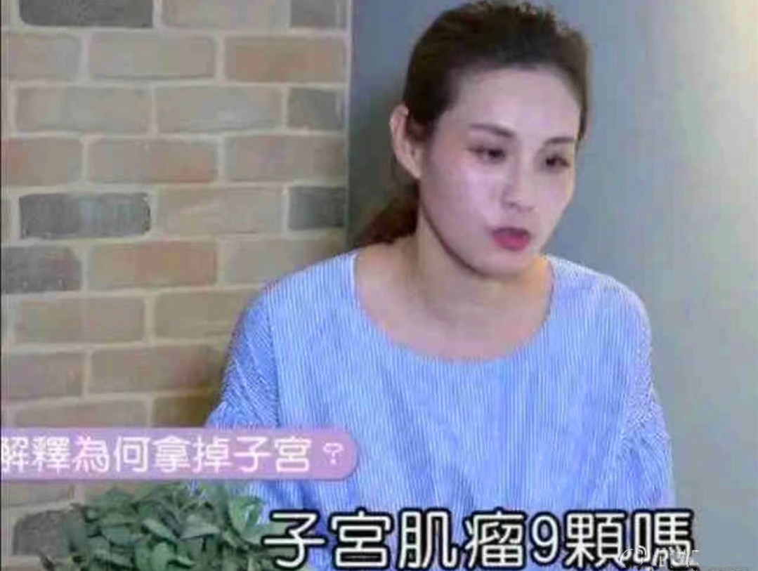 刘畊宏老婆：假小子变选美冠军，拒绝潜规则，4年3胎拿掉子宫