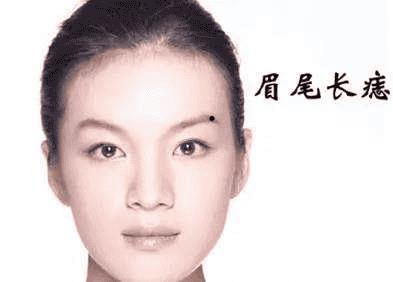 女人腋下有很多痣（腋窝下有痣的女人好不好）