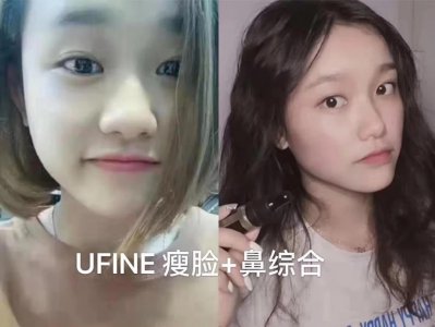 ​ufine 精油 新行骗局 消费者必看！！！